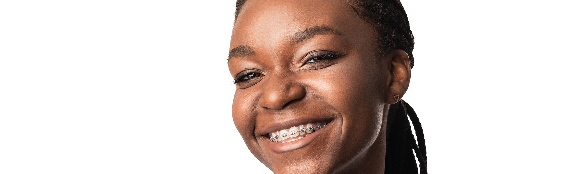Myths About Braces and Invisalign®: What Patients Need to Know